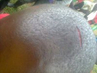 Blessure du major Janvier