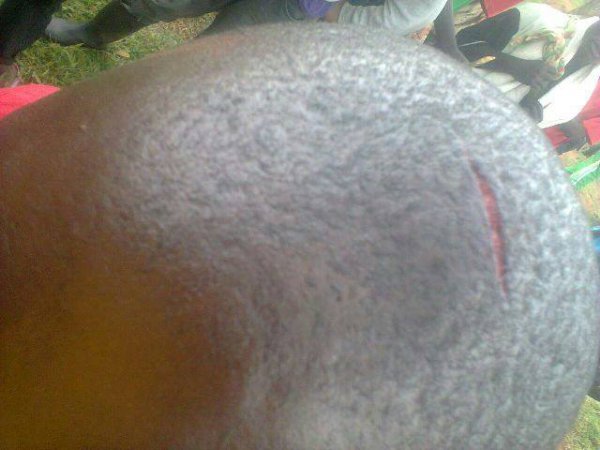 Blessure du major Janvier